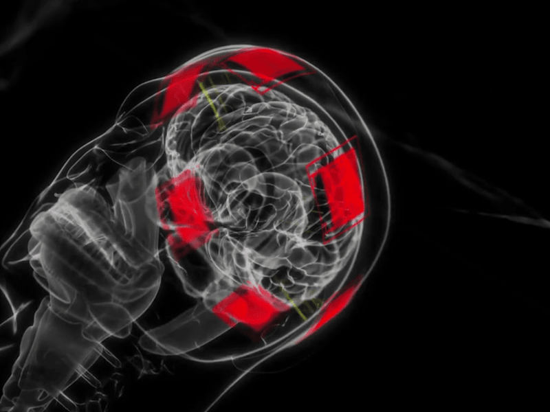 Cover image for 3d medical animation