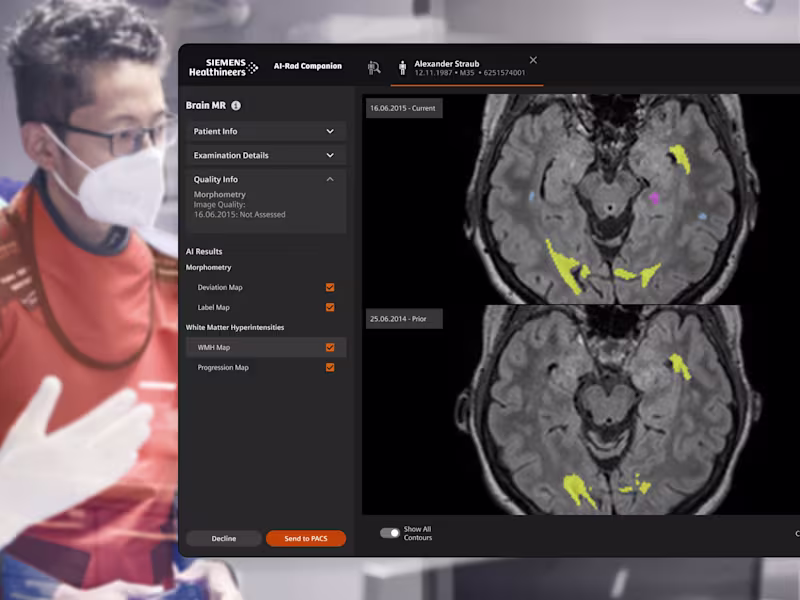 Cover image for Siemens Healthineers - AIRC — diagnostic UI design