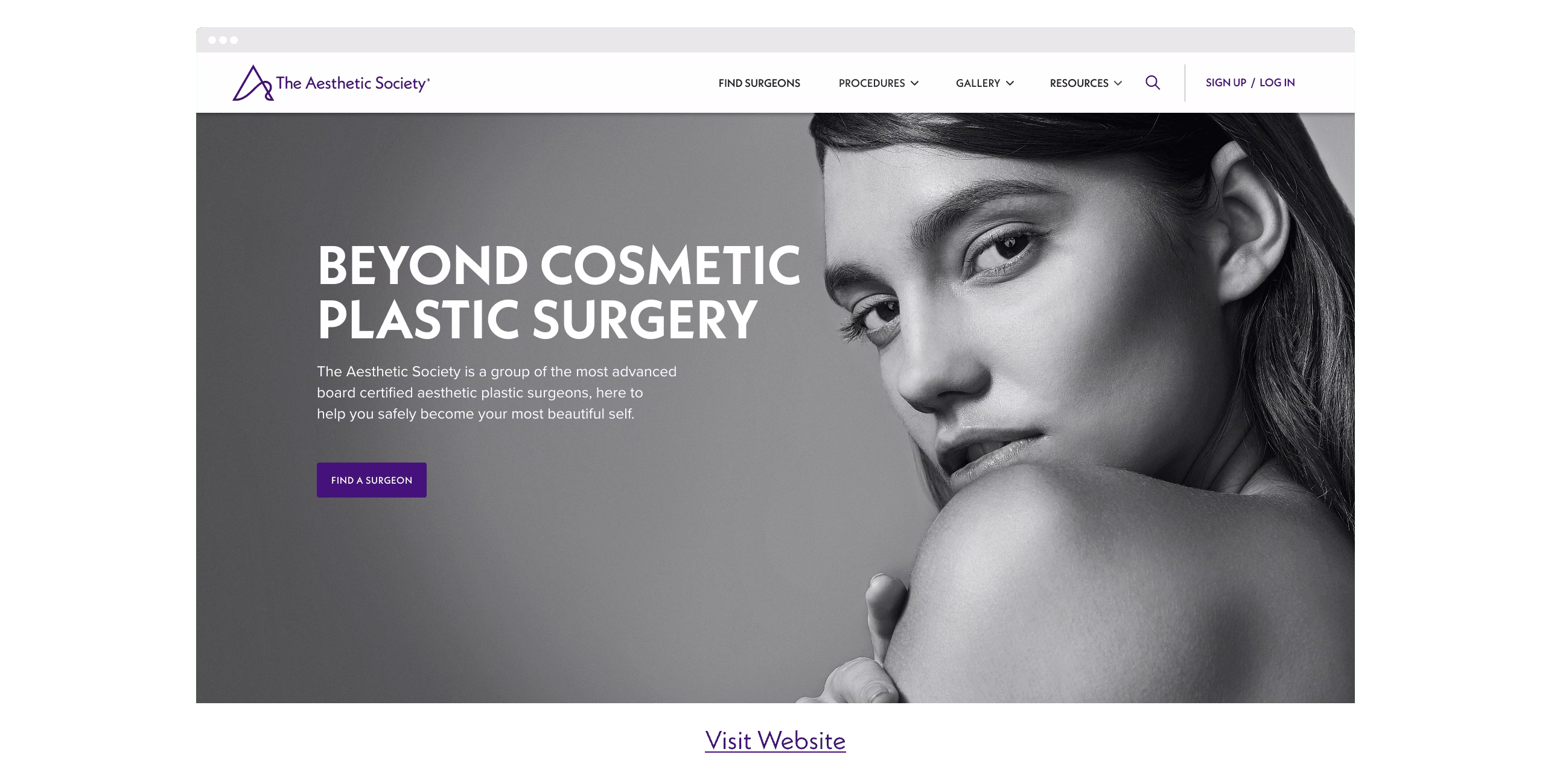 Placeholder project card media