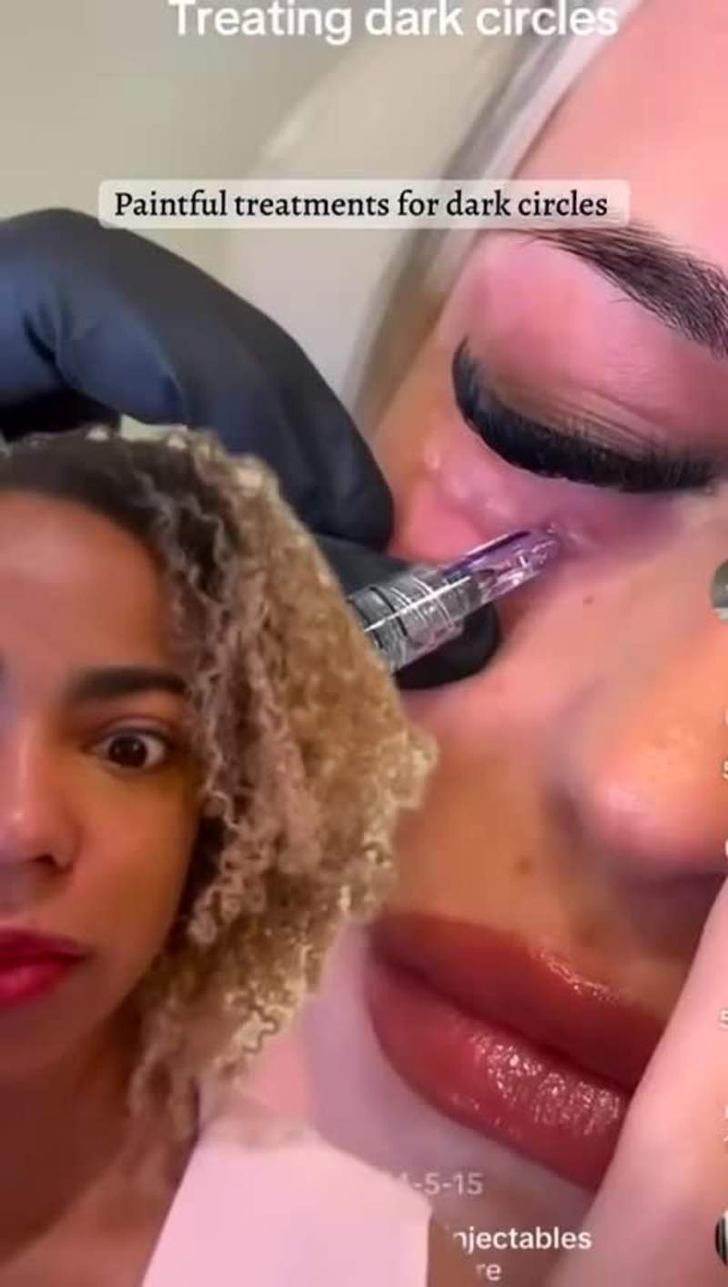 Cover image for Get the effects of messotherapy — with just an eye cream ! @...