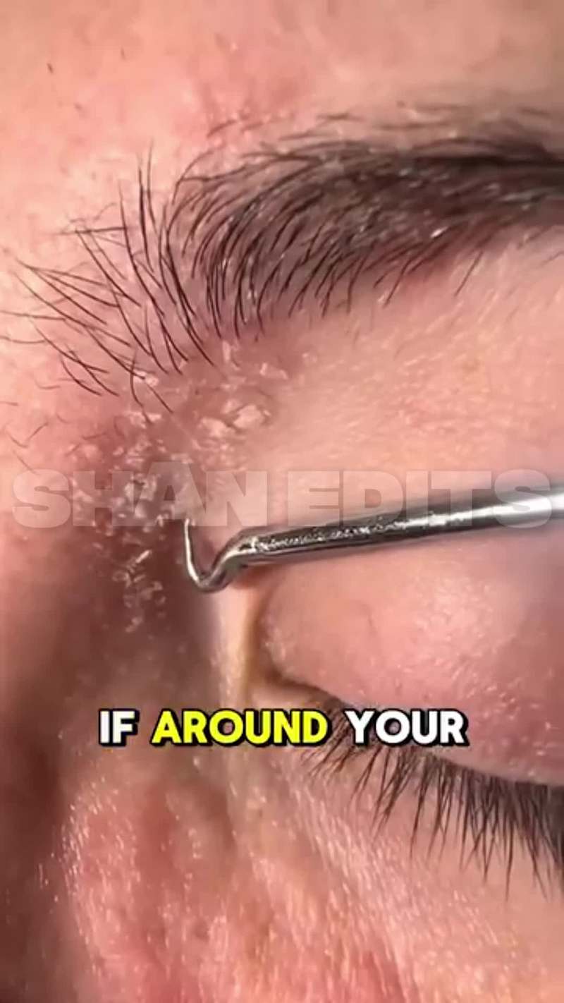 Cover image for Engaging Skincare Video Ads for TikTok & Instagram Reels