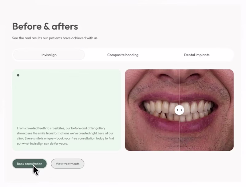 Cover image for Before & after slider section