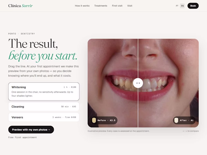 Cover image for Clínica Sorrir — a dental clinic website where you see the r...