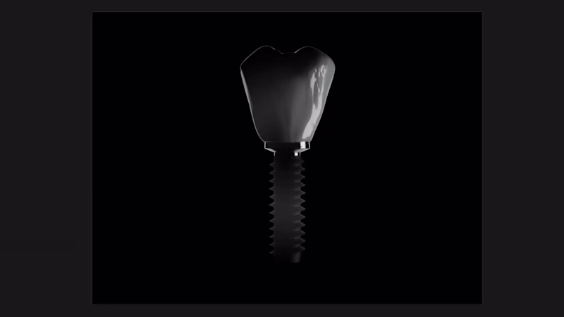 Cover image for Interactive Dental Implant Showcase
I designed