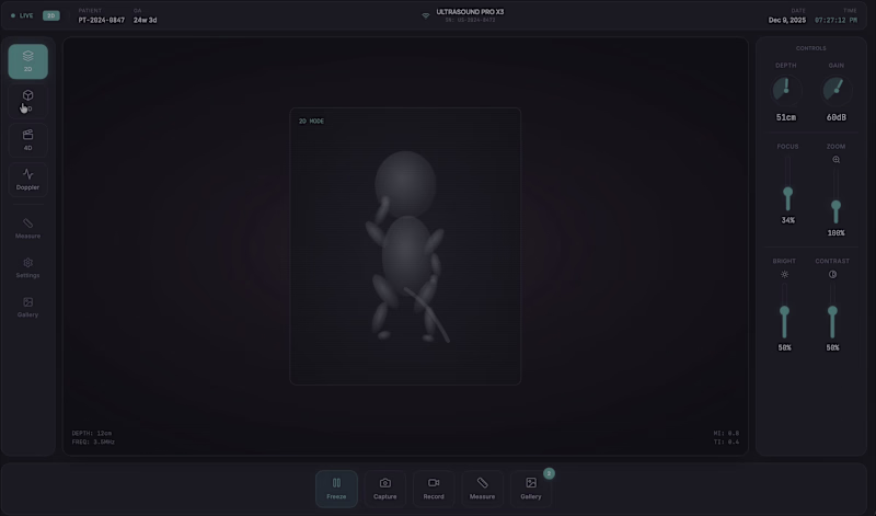 Cover image for NexGen Ultrasound UI – Redesigning 3D/4D Fetal Imaging Curre...