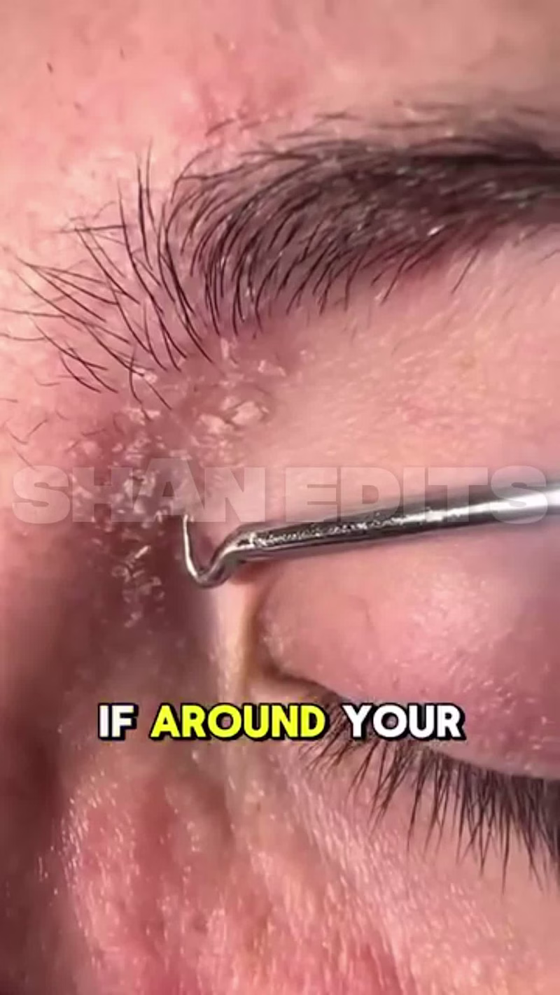 Cover image for Engaging Skincare Video Ads for TikTok & Instagram Reels